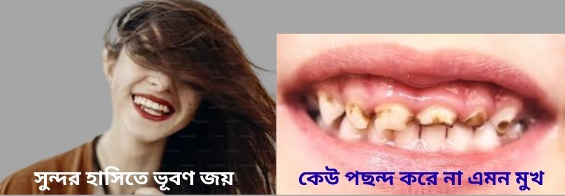 দাঁতের গোপন জীবন চিত্র: শিশুকাল, যৌবন-প্রৌঢ়ে রুট ক্যানেল আর বৃদ্ধকালে দাঁতহীন