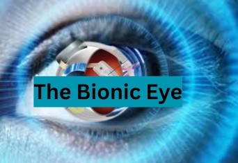 Glimmers of Hope: The Promise and Challenges of the Bionic Eye