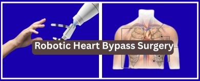 Robots at the Heart of Healing: Exploring Robotic-Assisted Coronary Bypass Surgery