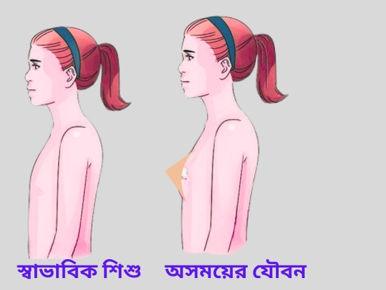 অসময়ের যৌবন- আশীর্বাদ নাকি অভিশাপ