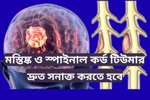মস্তিষ্ক ও স্পাইনাল কর্ড টিউমার সম্পর্কে সচেতন হউন