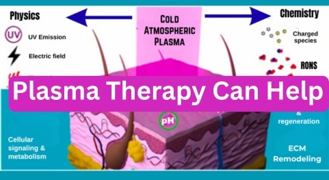The Role of Plasma Therapy: Unlocking the Healing Power