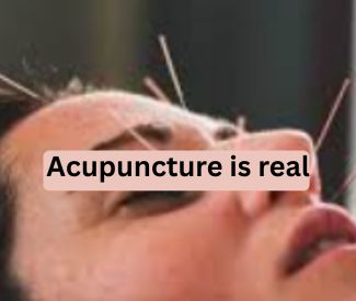 Traditional Medicines in the World: Science of Acupuncture Therapy