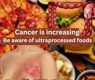 The Alarming Rise of Early-Onset Cancer: A Global Health Mystery